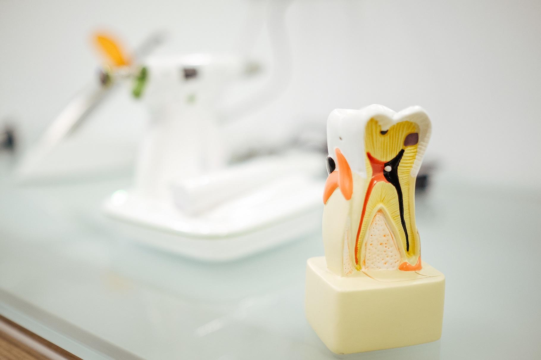 cómo se hace una endodoncia
